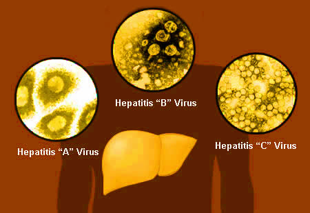 hepatitis viruse