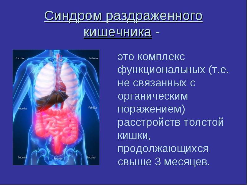 Синдром раздраженного кишечника Синдром раздраженного кишечника