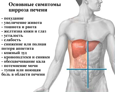 Цирроз печени. Сколько живут с циррозом