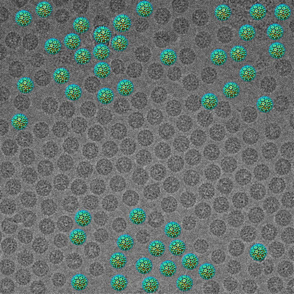 3D-реконструкция вируса гепатита B. (Daniel Beniac/FEI Image Contest)